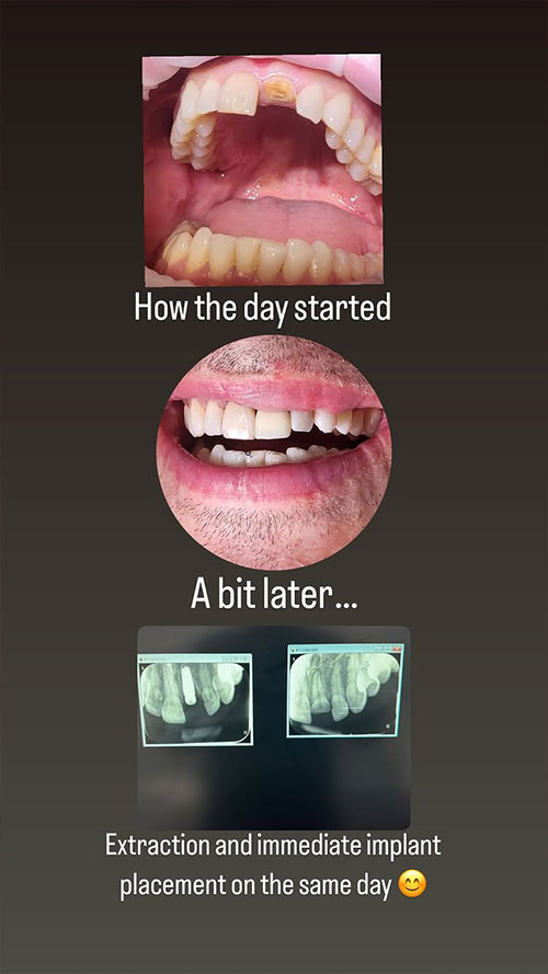 im1