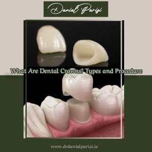 What Are Dental Crowns? Types and Procedure