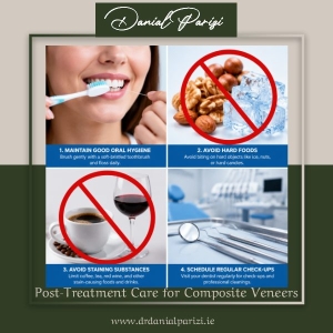 Post-Treatment Care for Composite Veneers