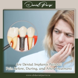 Are Dental Implants Painful? Pain Before, During, and After Treatment